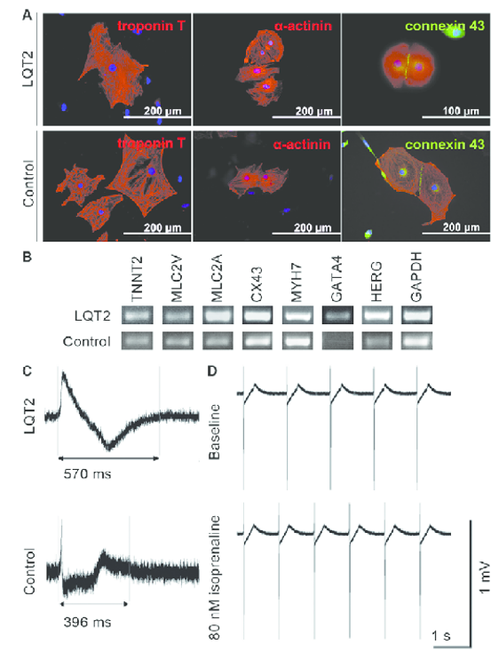 The expression of cardiac markers in iPSC-derived cardiomyocytes and the electrical properties of the cells.