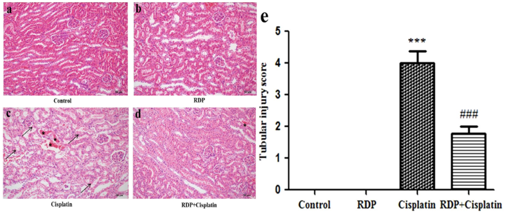 RDP treatment attenuated the renal histological changes induced by cisplatin in mice: (a) control group; (b) RDP alone group; (c) cisplatin-injected group; (d) RDP plus cisplatin group. Arrows show damaged tubular cells, stars show intratubular cast formation. H&E staining. Magnification 200X. Tubular score (e). Each data points represent mean±S.E.M.
