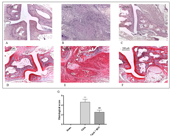 BCP Preserves Articular Cartilage. Representative H&E and Safranin O staining of joints from mice: Sham (A,D), CAIA (B,E) and CAIA + BCP (C,F). The graph (G) represents the histological score. Data are expressed as means ± SD. ***p<0.0001 vs. Sham; ##p<0.001 vs. CAIA.
