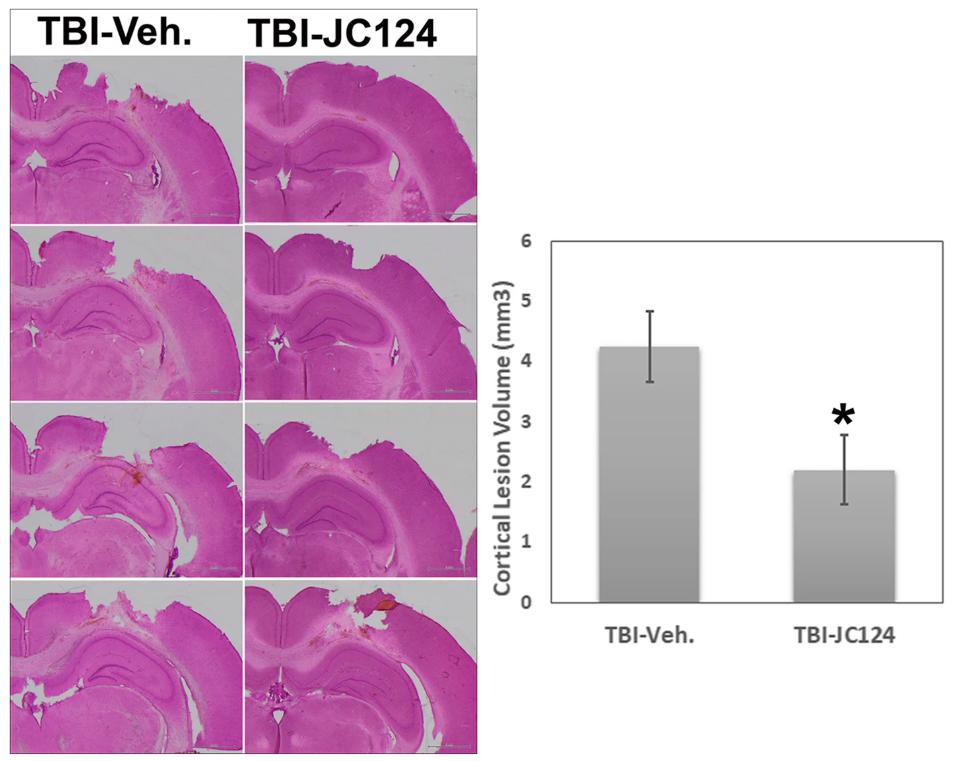 Fig. 2 JC124 treatment reduced the cortical tissue damage following CCI.