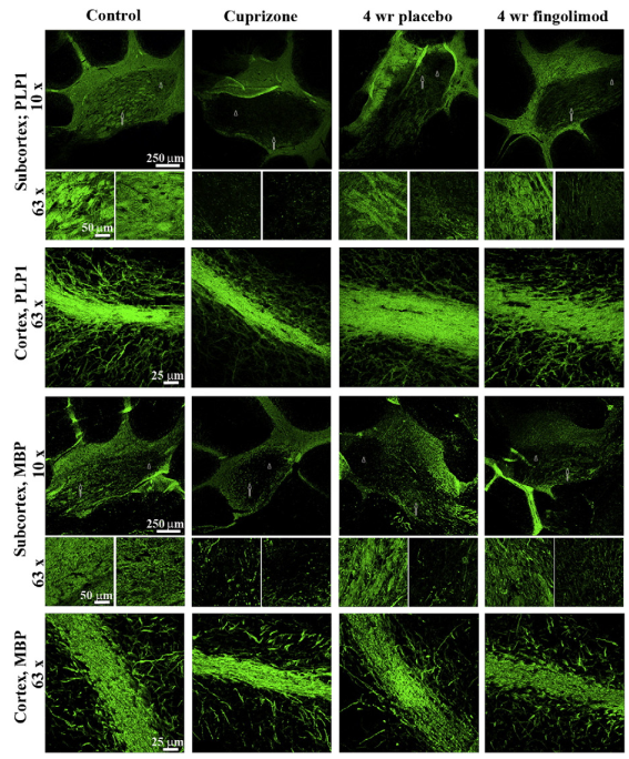 Representative pictures show myelination (PLP1 and MBP) in the subcortex and cortex of mouse cerebellum for control, 5 weeks of cuprizone exposure and after 4 weeks of fingolimod/placebo treatment.