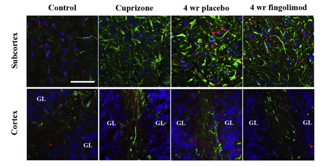 NOGO-A positive mature oligodendrocytes (red) and GFAP-expressing astrocytes (green) in subcortex and cortex in control, 5 weeks of cuprizone exposure and after 4 weeks of recovery.