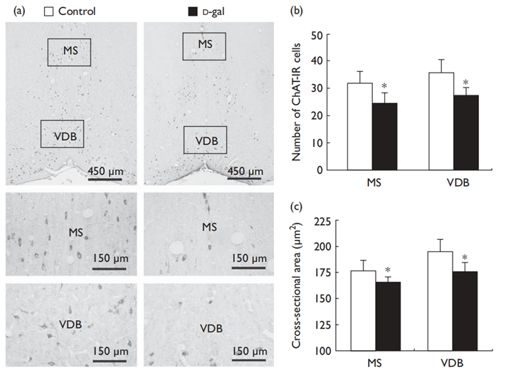 ChAT immunohistochemistryin the rat forebrain 6 weeks after D-galactose (D-gal) injection. (a) Compared with controls (left panel), the density of ChAT immunoreactive neurons was decreased in the vertical limb of the diagonal band of Broca (VDB) and the medical septum (MS) in D-gal-injected rats (right panel). (b and c) Quantified data for mean number and soma size of ChAT immunoreactive neurons in the VDB and MS in the two groups. *P<0.05 vs. control group. Data represent mean±stand deviation from six rats per group.