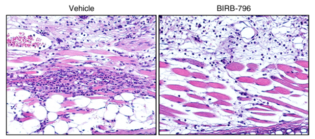 Histopathological evaluation of cellular infiltrates in the ears from KLH induced mice treated with BIRB-796.