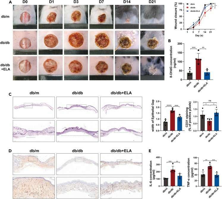 Elabela application in the peri-wound area promotes healing in diabetic mice