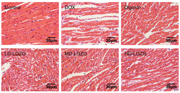 H&E-stained cardiac tissue.