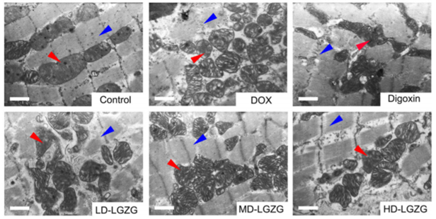 Representative TEM images of cardiac tissue (scale bar, 1 μm). Red arrows, mitochondria; blue arrows, myofibrils.