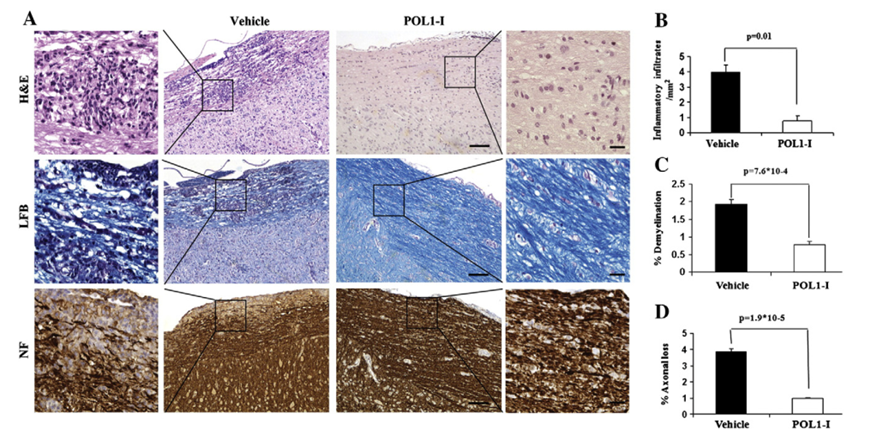 Attenuation of EAE by POL1-I. A. Representative images of H&E staining (upper panel), LFB (middle panel) and NF staining (lower panel) in adjacent longitudinal spinal cord sections, day 14 post-POL1-I treatment. The boxed areas in the middle images are ×10 magnification. The squared external images are ×40 magnified images representative of solid squares in corresponding×10 images and point to areas of cellular infiltration, demyelination and axonal loss in the vehicle mice sections compared to POL1-I sections. Scale bar in middle images = 100 μm, magnified boxed images = 20 μm. B. Mean number of inflammatory infiltrates per mm2 in adjacent longitudinal spinal cord sections. C. The percentage of demyelinating areas in adjacent longitudinal spinal cord sections. D. The percentage of axonal loss area in adjacent longitudinal spinal cord sections. White columns represent POL1-I treated group and black columns represent Vehicle group.