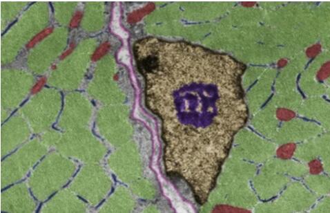 Human Skeletal Muscle Satellite Cells