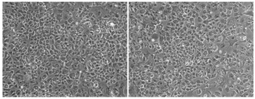 Immortalized Chicken Hepatocytes, Chicken Hepatocyte Immortalization, Cell Immortalization, Cell Immortalization Service, Non-Viral Cell Immortalization Method, Epigenetic Induction of Cell Growth Service, hepatocyte immortalization, immortalized hepatocytes