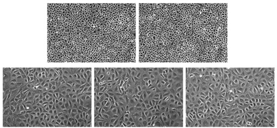 Immortalized Monkey Hepatocytes, Monkey Hepatocyte Immortalization, Cell Immortalization, Cell Immortalization Service, Non-Viral Cell Immortalization Method, Epigenetic Induction of Cell Growth Service, animal cell immortalization, hepatocyte immortalization, immortalized hepatocytes