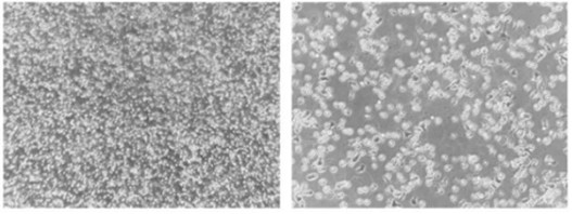 Immortalized Human T Cells, Human T Cell Immortalization, Cell Immortalization, Cell Immortalization Service, Non-Viral Cell Immortalization Method, Epigenetic Induction of Cell Growth Service, Immune cell immortalization