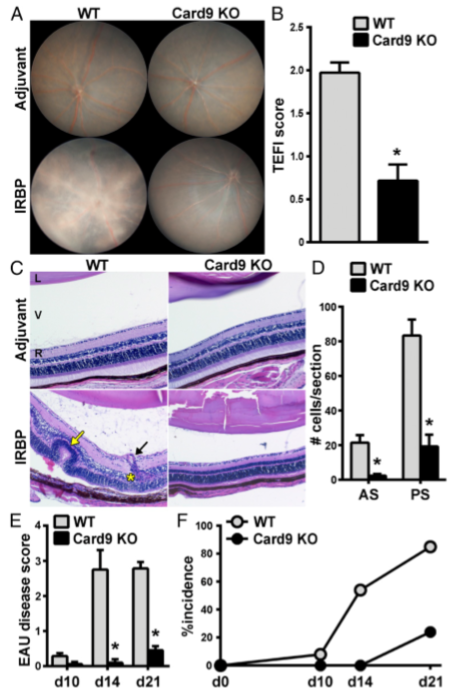 Card9 is required for the inflammatory pathology in EAU. EAU was induced in WT and Card9 KO mice, and the onset and severity of uveitis were evaluated by clinical fundoscopy examination (A and B) and histopathology (C-E). (A) Representative fundus images of the posterior pole showing extensive inflammation (e.g., diffuse retinal lesions and vascular cuffing) in WT compared with Card9 KO eyes. (B) Clinical severity of retinal inflammation evaluated by fundoscopy. (C) H&E-stained sections of eye harvested on day 21 postimmunization (i.e., peak of disease) show pathological features within this disease including retinal folding (yellow arrow), granulomatous formation (yellow asterisk), and vasculitis (black arrow). Images acquired at 200 × magniﬁcation. (D) Quantification from histological sections of the number of cells infiltrated into the anterior and posterior segments. EAU disease was graded pathologically as a function of time (E) and used to calculate incidence over time (F).