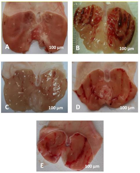 Fig. 1 Effect aerial part extract of Ranunculus millefoliatus on macroscopic appearance of alcohol-produced stomach damage. A. Negative group obtainable unbroken gastric epithelial surface. B. Ulcer control group displayed extensive hemorrhagic lacerations of stomach epithelium. C. Omeprazole group demonstrated slight injuries to stomach mucosa. D. & E. Experimental groups showing reduction in gastric ulcer.