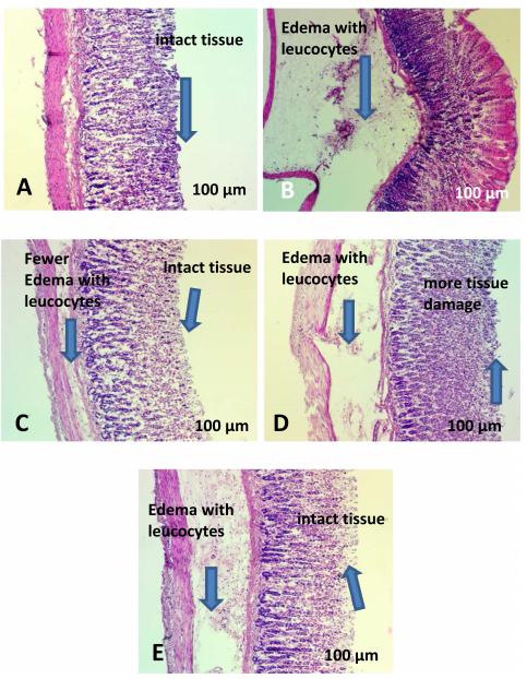 Fig. 2 Effect of aerial part extract of Ranunculus millefoliatus on histology structures of stomach against ethanol-induced mucosa damages (H & E stained 10x). A. Normal group (G1) showed intact stomach epithelium. B. Ulcerated control group (G2) show widespread epithelial damage, edema leucocytes infiltration of submucosal coating. C. Reference group (G3) observing minor mucosa injury. D & E Investigational (G4, G5) groups exhibition decrease stomach epithelial injury.