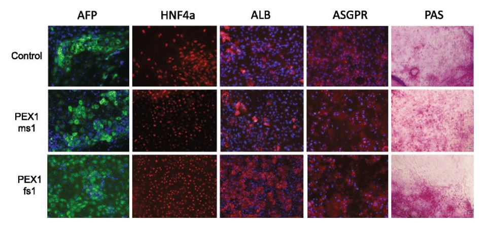 Characterization of iPSC-derived hepatocytes by immunostaining and Periodic acid-Schiff staining (PAS). Expression of AFP (green), HNF4a (red), ALB (red), and ASGPR (red) were detected by immunostaining. Blue represents DAPI staining. PAS staining was used to indicate glycogen storage.