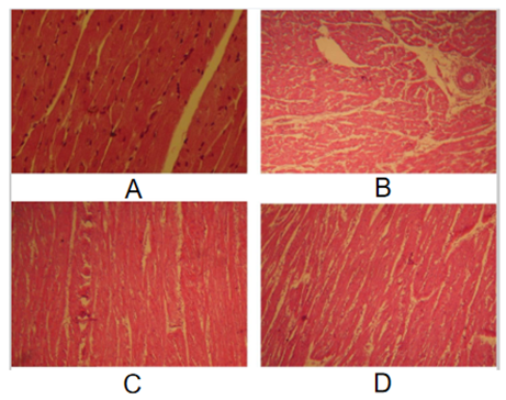 Representative micrographs from the heart exhibiting the protective effect of methanol M. oleifera leaf extract (MEML) on high-fat diet-induced cardiac injury in rats. (A) Control groups showing normal cardiac architecture. (B) High-fat diet-treated group showing anarchized myocardial fibers associated with interstitial edema and inflammatory cellule collections. (C) High-fat diet group received MEML (200 mg/kg) showing repair in the histological sections. (D) High-fat diet group treated with MEML (400 mg/kg) showing normal structure almost similar to control. Heart sections were stained using hematoxylin-eosin method.