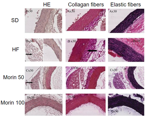 Effect of Morin on histology of isolated rat aorta. Histological sections of the aortae of all animals were stained with hematoxylin and eosin (H & E) to study their general structures, whereas to investigate collagen and elastic fibers sections, van Gieson and Verhöeff's stains, respectively, were used (x30).