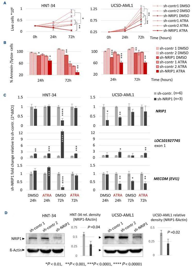 The retinoic acid receptor co-factor NRIP1 is uniquely upregulated and represents a therapeutic target in acute myeloid leukemia with chromosome 3q rearrangements.
