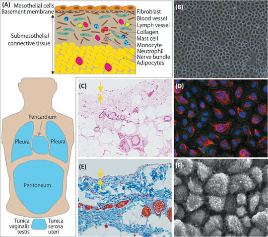 (A) The fundamental structure of mesothelium is composed of a superficial monolayer of mesothelial cells (MCs), the basement membrane, submesothelial connective tissue containing fibroblasts, blood and lymph vessels, collagen tissue, inflammatory cells, nerve bundles and adipose tissue. Panel (B) shows a phase-contrast microscopic image of parietal peritoneal MCs from a rodent. Panel (C) shows a human peritoneal biopsy with a superficial monolayer of MC (yellow arrows) underpinned with submesothelial connective tissue (HE staining). Panel (D) shows MCs from the parietal peritoneum of a rodent. MCs express cytokeratin (red) and Zo-1 (green). (E) Masson Trichrome staining of the mesothelium showing keratin (red) and collagen (blue/green). Panel (F) shows a scanning electron microscopy image of parietal peritoneal MCs from a rodent.