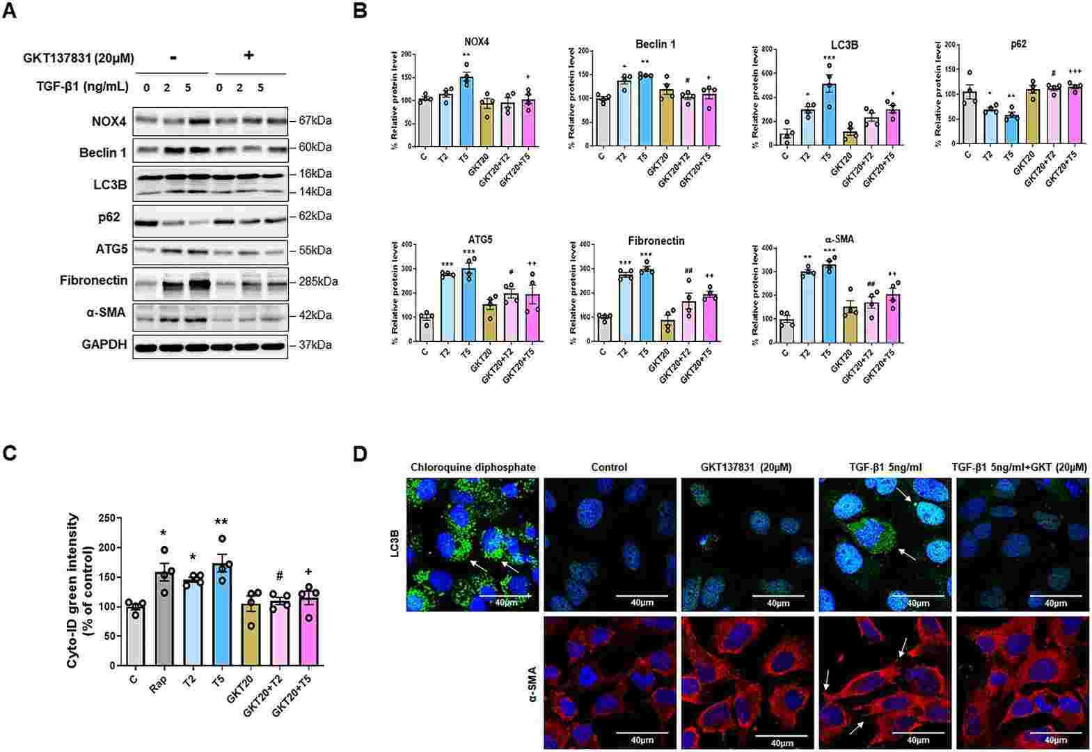 The effects of NOX4 inhibition on TGF-β1-induced autophagy activation and epithelial-to-mesenchymal transition (EMT) in HPMCs.