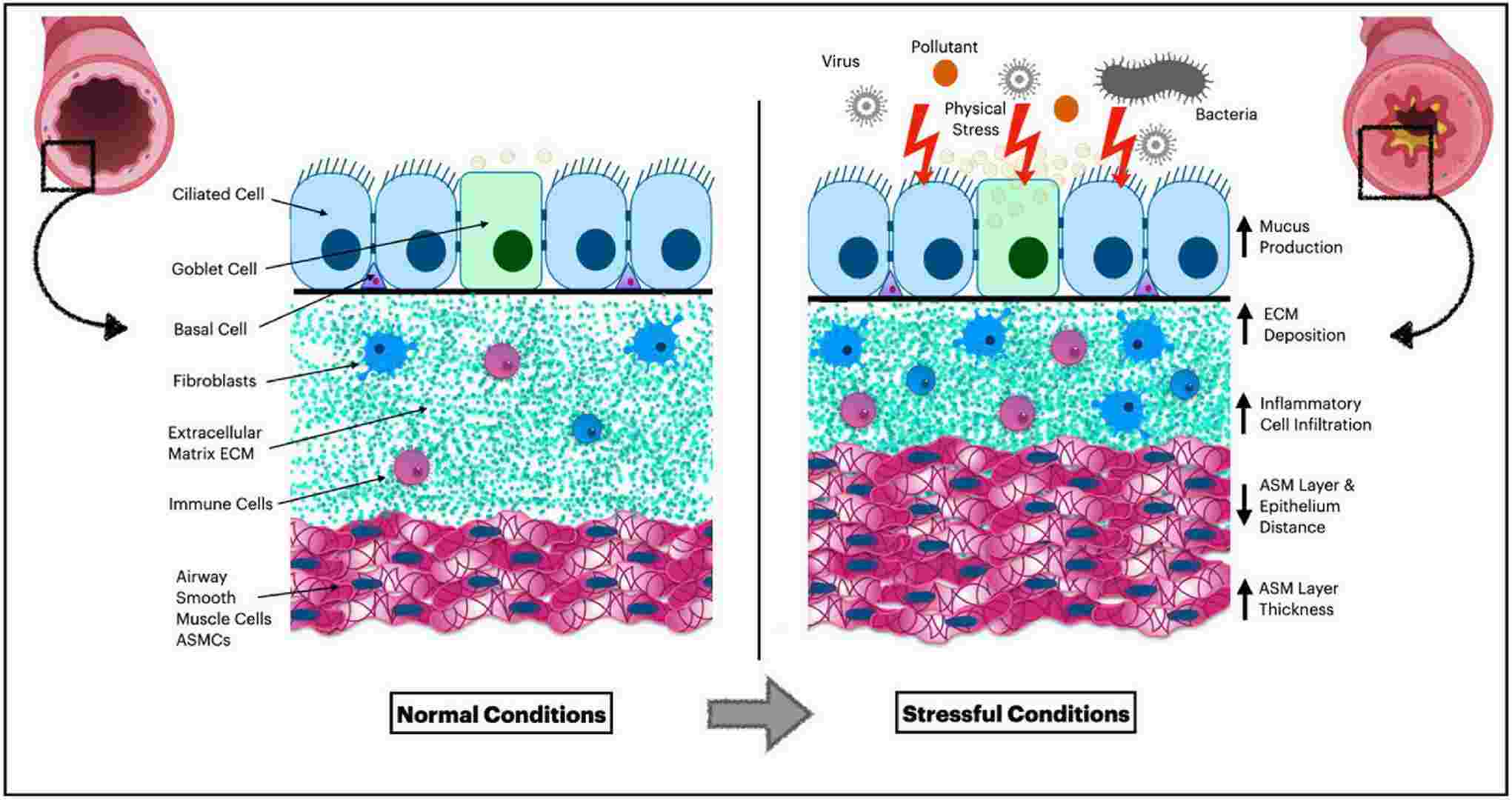 Adaptation of airway wall layers in response to stressful conditions, including inflammation, infection, and irritation from internal or external agents.