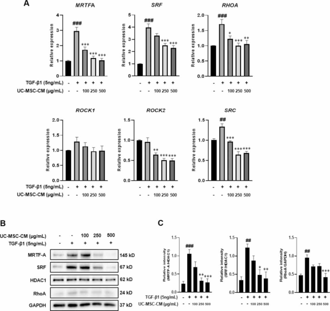 RT-qPCR analysis of the relative mRNA expression of MRTFA, SRF, RHOA, ROCK1, ROCK2, and SRC. Representative western blots showing the protein expression of MRTF-A and SRF.