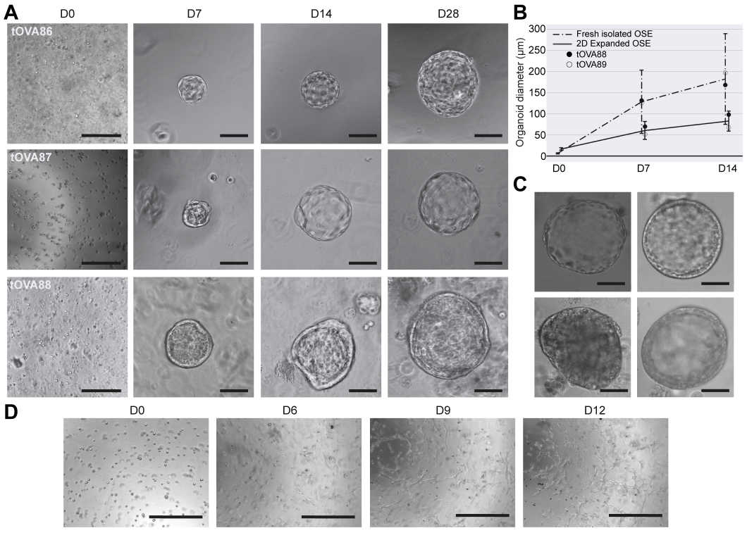 Brightfield images of three independent hOSE organoid derivations from three different donors (tOVA86, tOVA87, tOVA88).
