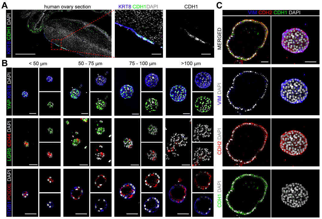 Immunofluorescence for KRT8 and YAP, LGR5 and CD44, and ITGB1 and PODXL in hOSE organoids of different sizes (<50 µm, 50-75 µm, 75-100 µm, >100 µm).