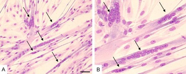Example of myotubes formation in differentiated myoblasts cultured in DMEM+FBS+FGF medium and stained with Pappenheim staining method.