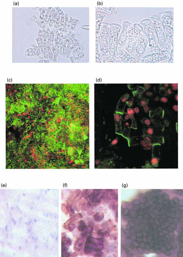 Epithelial cells cultured over LP fraction and allo-B cells after isolation and after different lengths of culture.