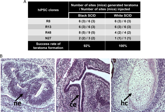 hiPSC clones isolated based on morphology with and without using retroviral silencing as a marker generates high grade teratomas.