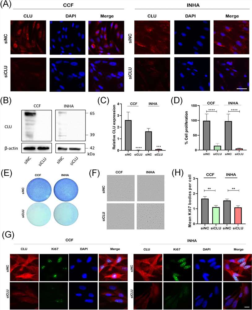 Clusterin Deficiency Promotes Cellular Senescence in Human Astrocytes
