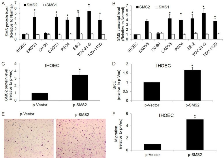 Analysis of SMS1 and SMS2 in ovarian cancer cells compared with normal immortalized human ovarian epithelial cells (IHOEC). Analysis of SMS2 level in IHOEC cells after transfection of SMS2-overexpressing plasmid.