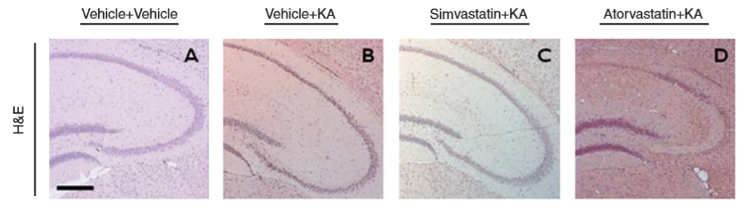 Effect of statin treatment on hippocampal damage induced by KA (kainate) 