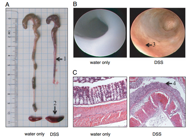 DSS-induced intestinal inflammation in mice. Eight-week-old C57BL6 mice were given 2.5% DSS in drinking water for 7 days. Control mice were given water only. On day 8, mice were sacrificed and monitored for colitis. (A) Gross picture of colons. (B) Endoscopic examination of colons. (C) H&E-stained colonic sections. Arrows indicate: (1) shortened and bleeding colons, (2) enlarged spleen, (3) superficial inflammation, (4) epithelial erosion and immune cell infiltration in DSS-treated mice.
