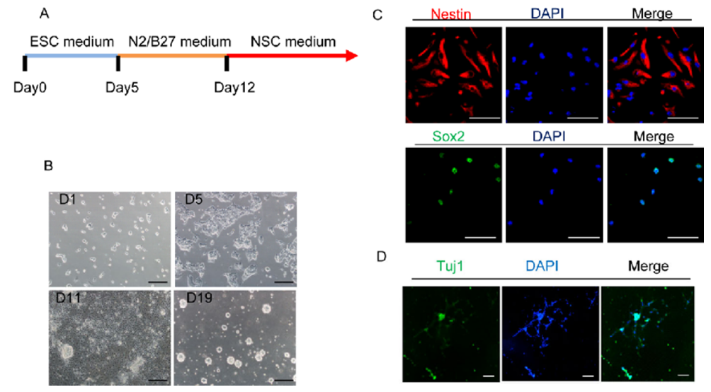 Generation and characterization of neural stem cells derived from iPSCs.
