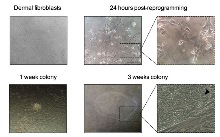 Example of iPSC reprogramming. Phase contrast images taken after reprogramming, showing the morphological changes occurred after transduction.