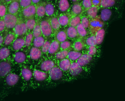 CABR™ Detection Probes