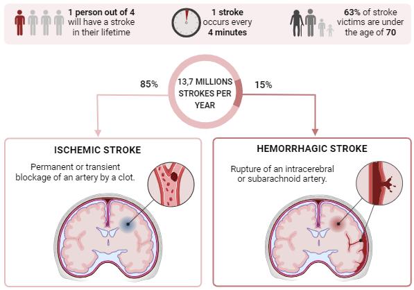 Fig. 1 Epidemiology and definitions of ischemic and hemorrhagic strokes