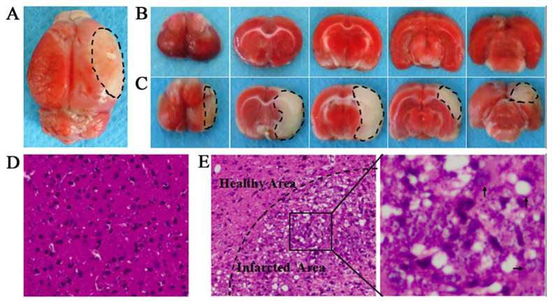 Fig. 2 (A) The complete brain of middle cerebral artery occlusion (MCAO) models.