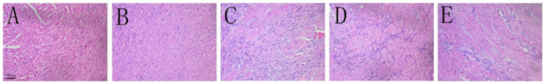 Effect of OMT on cardiac histopathological changes of ISO-induced heart failure rats (H&E staining 200×). (A) Control. (B) OMT 100 mg/kg. (C) Isoproterenol 5 mg/kg. (D) OMT 100 mg/kg + isoproterenol. (E) OMT 50 mg/kg + isoproterenol.