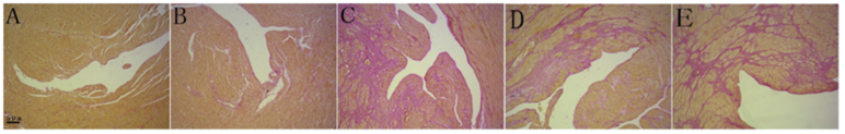 Representative Van Gieson-stained sections of the cardiac apex (100×). (A) Control. (B) OMT 100 mg/kg. (C) Isoproterenol 5 mg/kg. (D) OMT 100 mg/ kg + isoproterenol. (E) OMT 50 mg/kg + isoproterenol. Red indicates fibrotic regions.(For interpretation of the references to colour in this figure legend,the reader is referred to the web version of this article.)