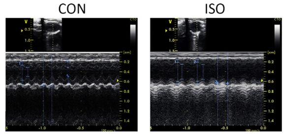 Representative raw tracings of M-mode echocardiography