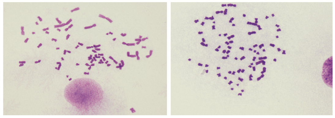 Premature Chromosome Condensation (PCC) Images (human cells)