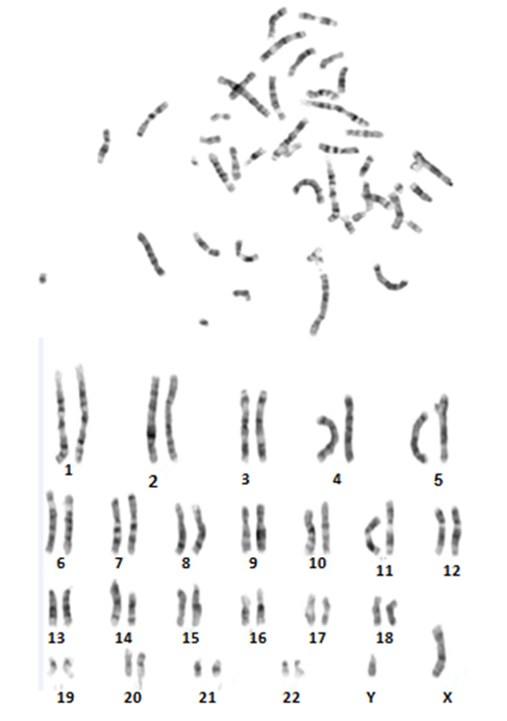 Normal Karyotype generated from human male cultured cells (46, XY)
