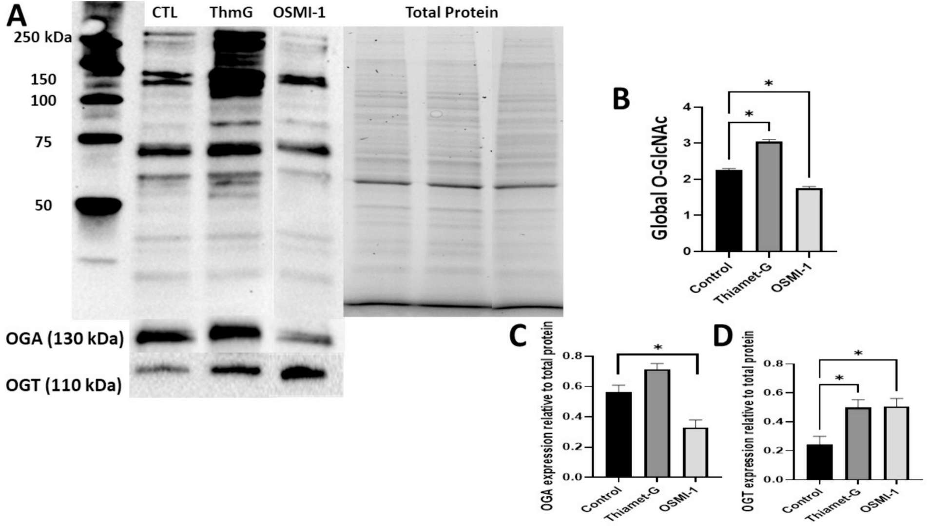 Immunoblots of O-GlcNAcylation, OGA and OGT expression in KGN cells.