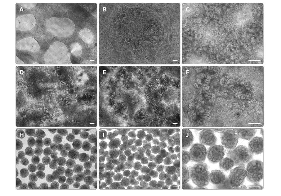 Kidney Organoid Differentiation