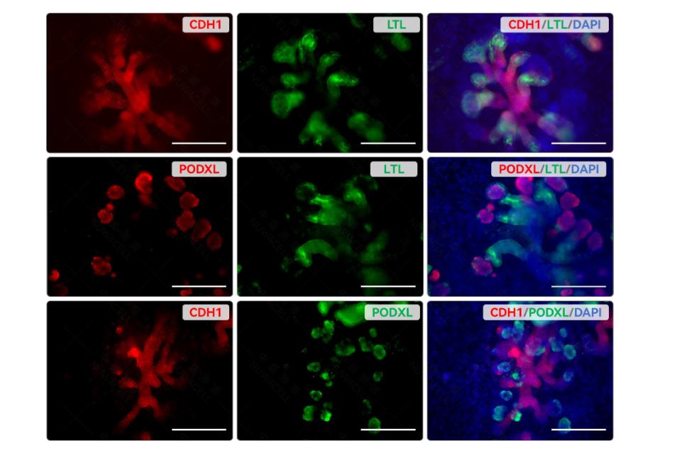 Kidney Organoid Differentiation