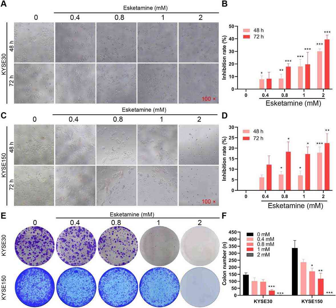 Esketamine suppressed the esophageal squamous carcinoma cell growth.